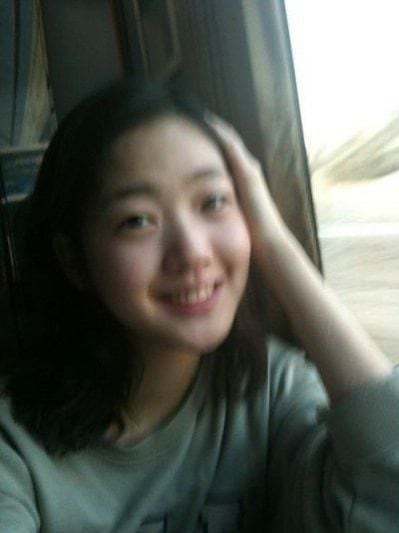 金高银出道前照片真的完全没有动的一张脸