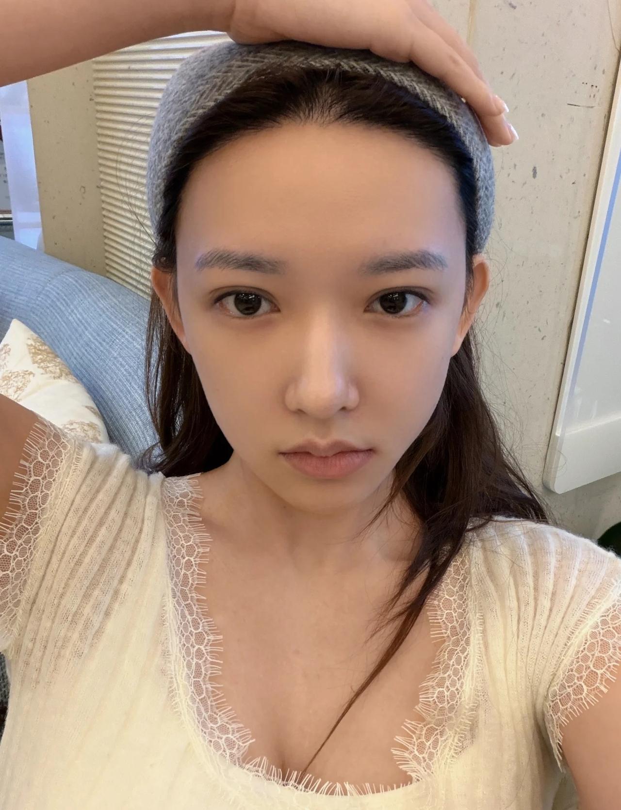 妈呀。素颜。。。女神这面部折叠度。。。拔个智齿都这么萌！！​​​