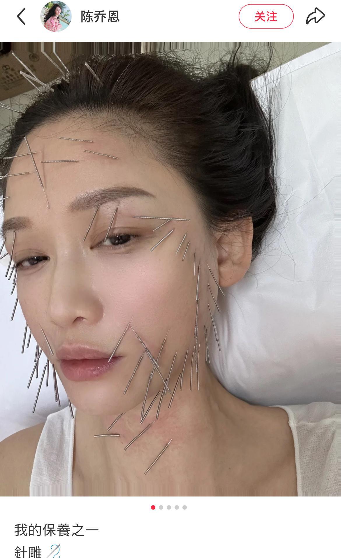 知道女明星对自己狠，但不知道竟然这么狠！陈乔恩不愧是演过东方不败的，这针雕太吓人