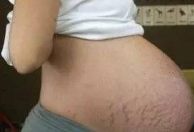 怀孕七个月肚子大, 去医院做产检, 才知道怀了几个孩子