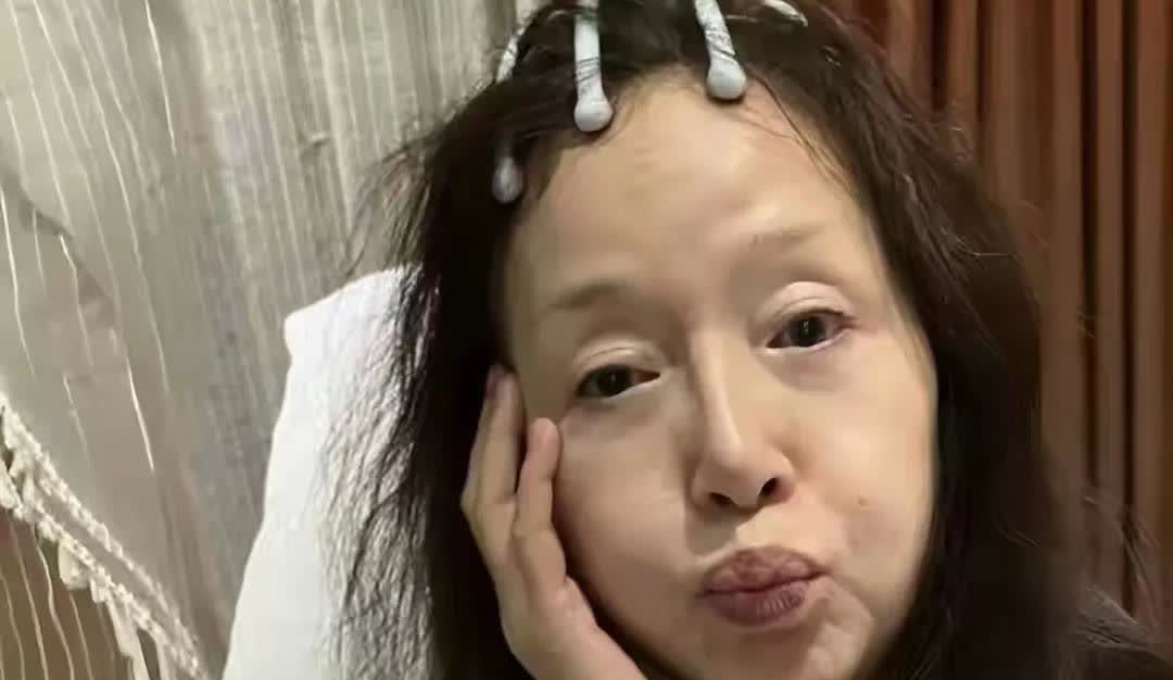 67岁的恬妞居然老成这样，不做医美的脸就会断崖式衰老，可是做医美又会馒化僵硬还是