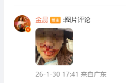 金晨交通事故致歉：受伤照曝光，深感惭愧诚恳反省