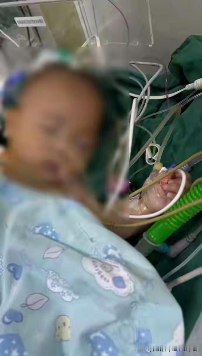 5月龄女婴心脏手术后离世事件调查结果公布。官方通报指出，医疗团队存在手术风险评估