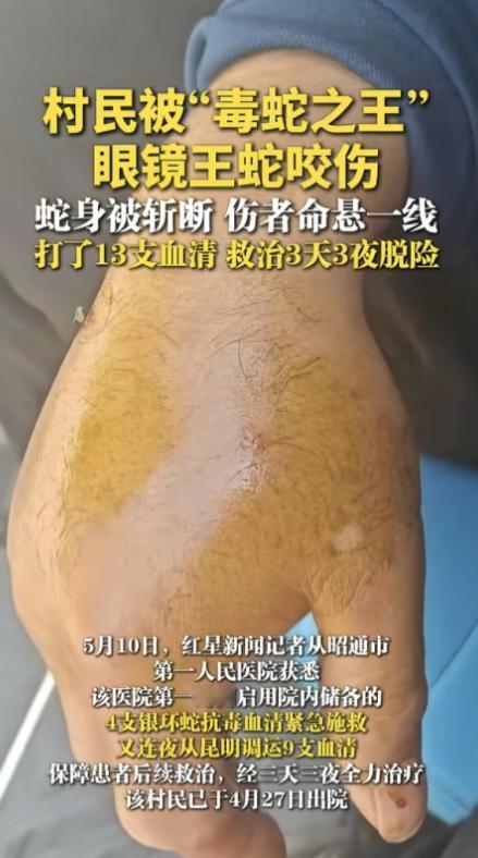 “打蛇不死反成仇”，据媒体5月10日报道，4月下旬云南昭通一名村民劳作时遭遇了一
