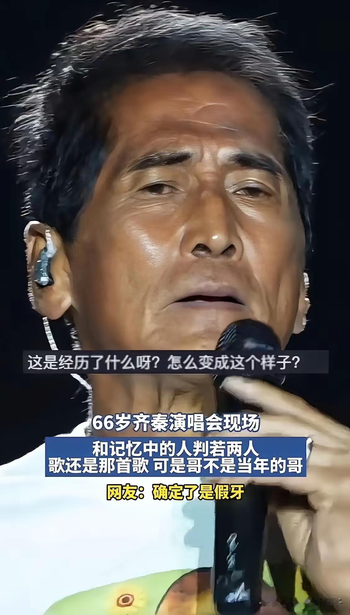 哎哟我去看到齐秦我真是两眼一黑这咋老成了这样呢？明星比素人有钱啊！咋不保