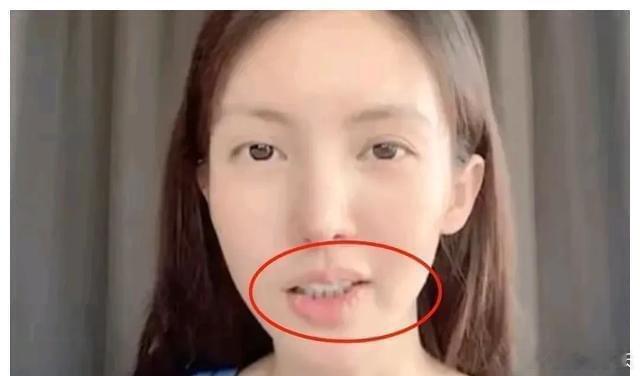 金晨这是事故发生后，先修脸后修车的意思？