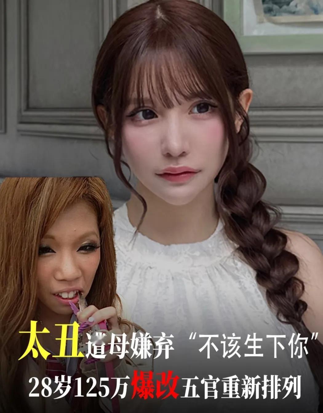 26岁的日本网红，因为整容后模样美丽而走红，她坦言从小就被母亲嫌弃长得丑，甚至直
