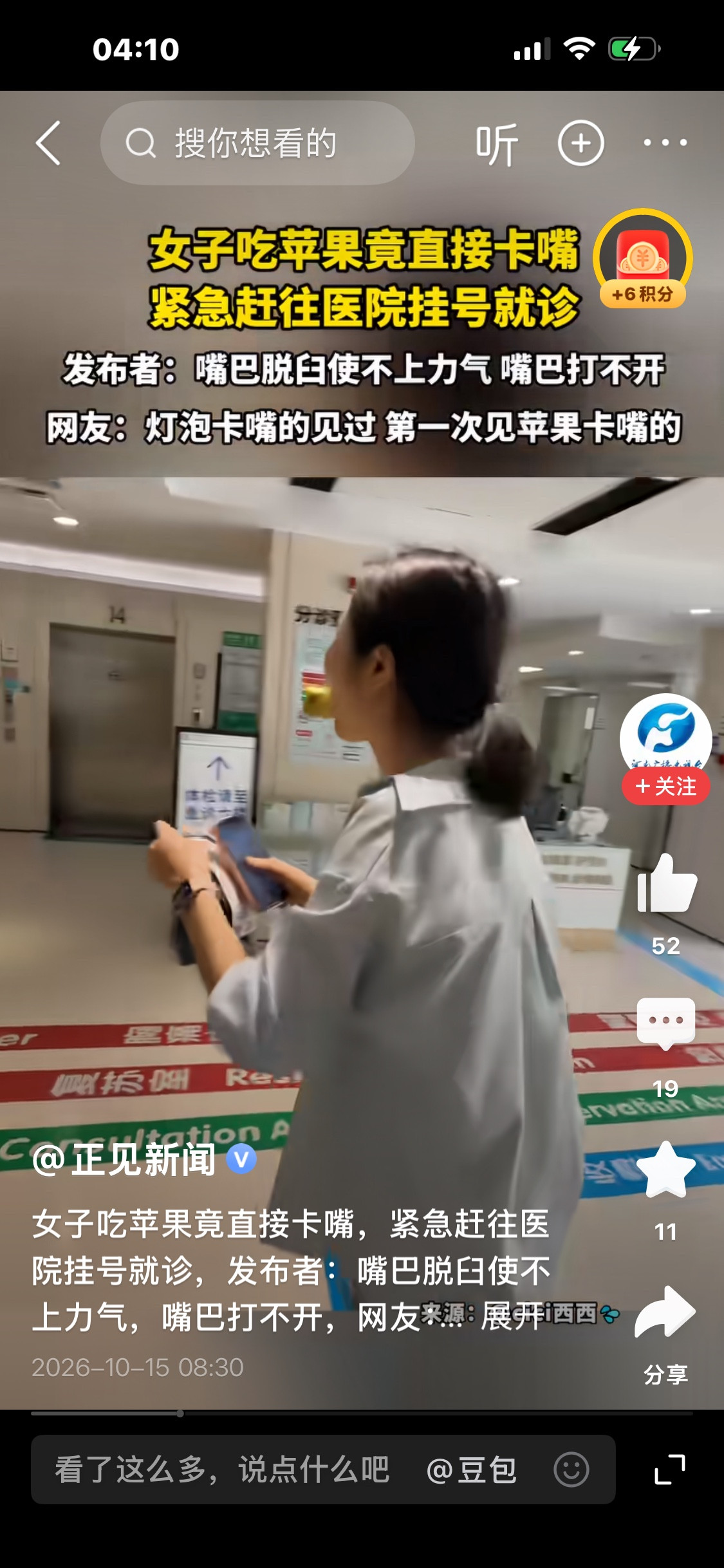 一口苹果引发意外！杭州女子大口啃苹果，下巴当场脱臼，含着苹果紧急奔医院浙江杭州，姜女士怎么也没想到，