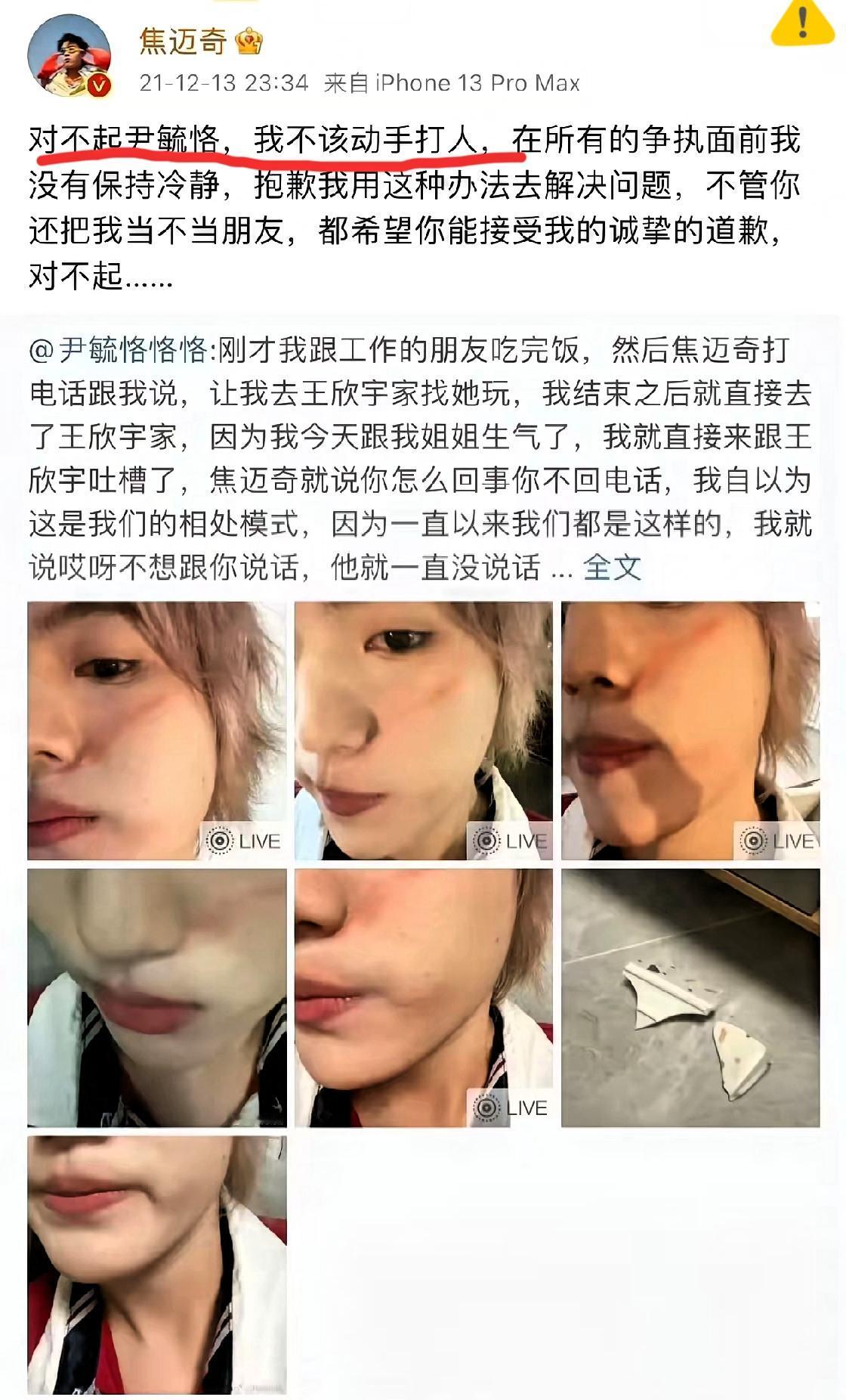 焦迈奇旧闻被扒：时间不是污点的“橡皮擦”网友的“考古”能力永远让人惊叹！