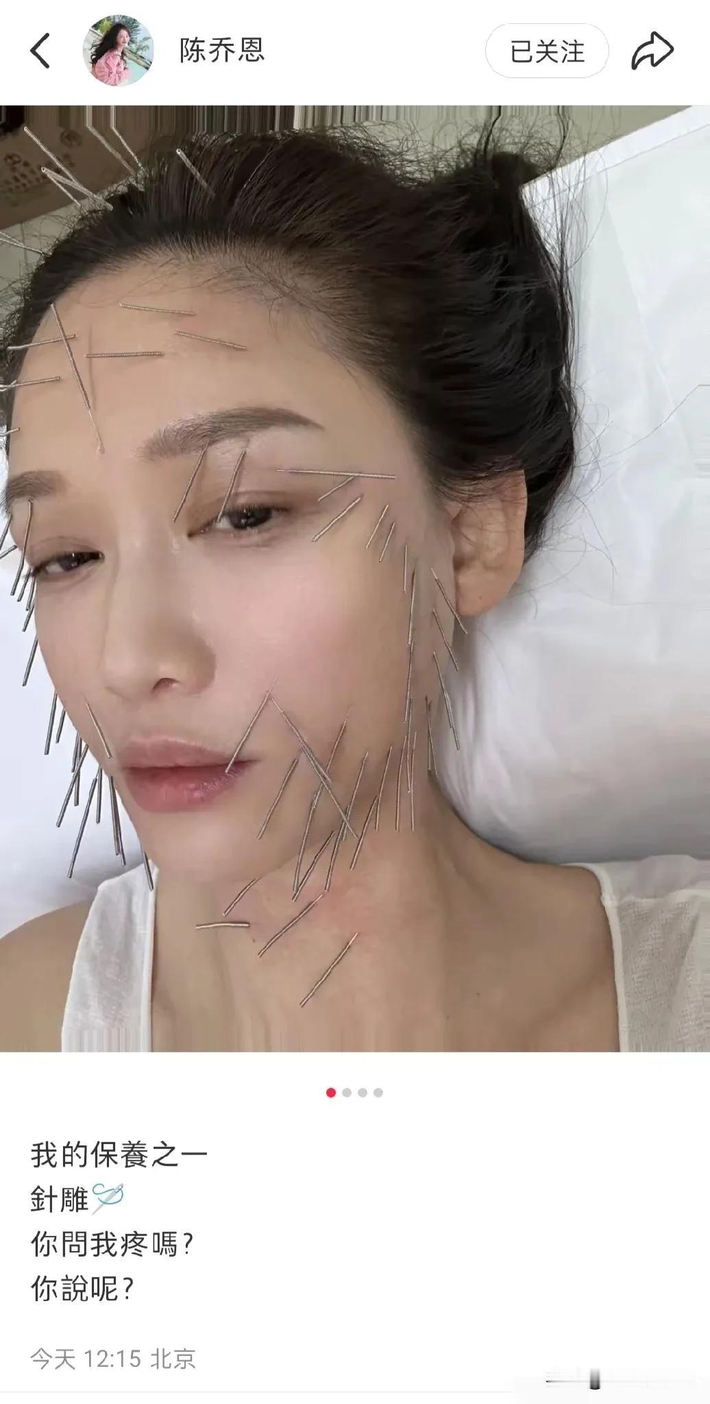 一般人还真做不了明星！看看人家陈乔恩，为了美，做什么针雕！不仅头、脸，还有脖子