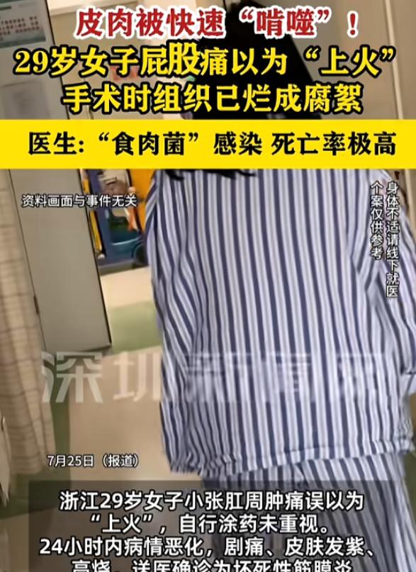 “悲剧还是发生了！”7月25日报道，浙江，一女子肛周肿痛，她以为是“上火”，涂了