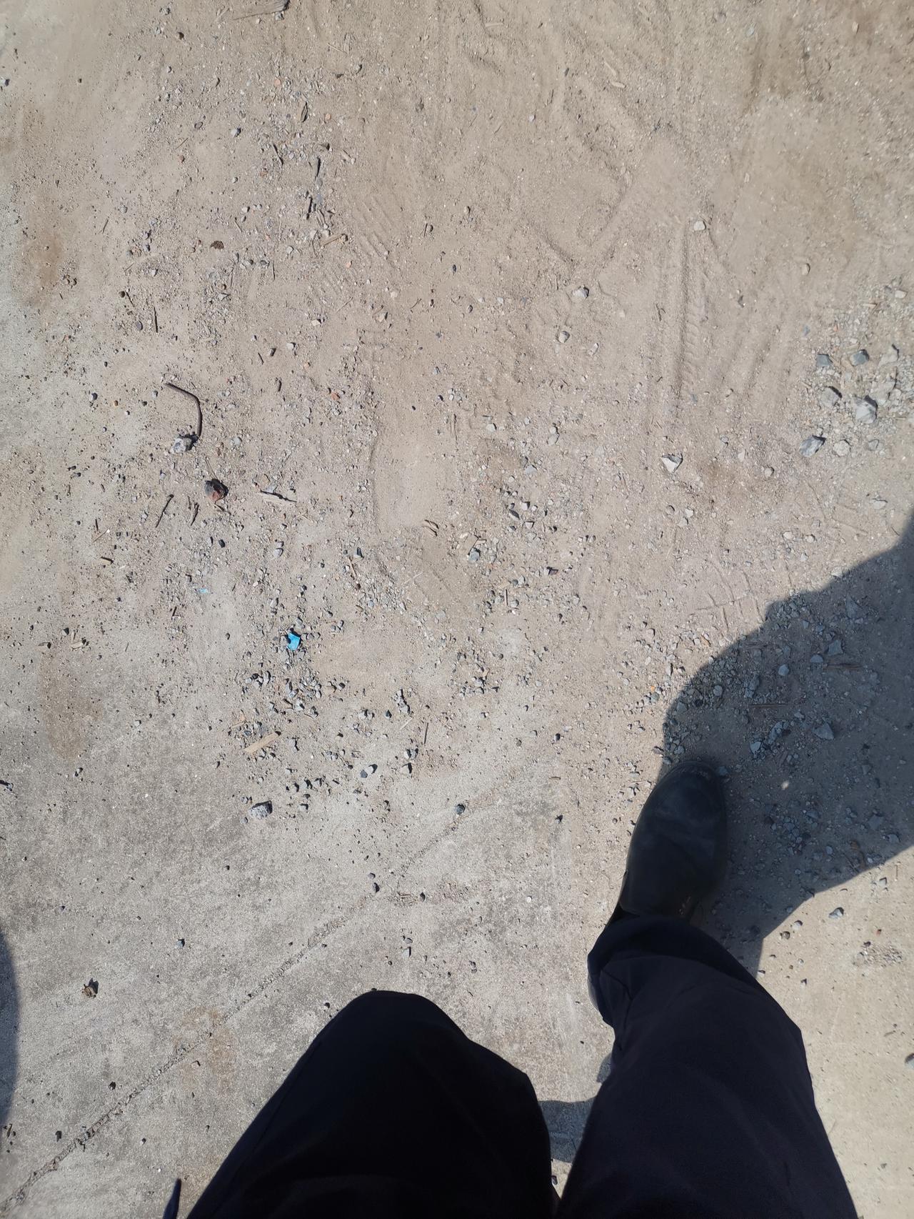 得肾病的人，10个有10个都不喜欢晒太阳，没有一个例外。喜欢熬夜，喜