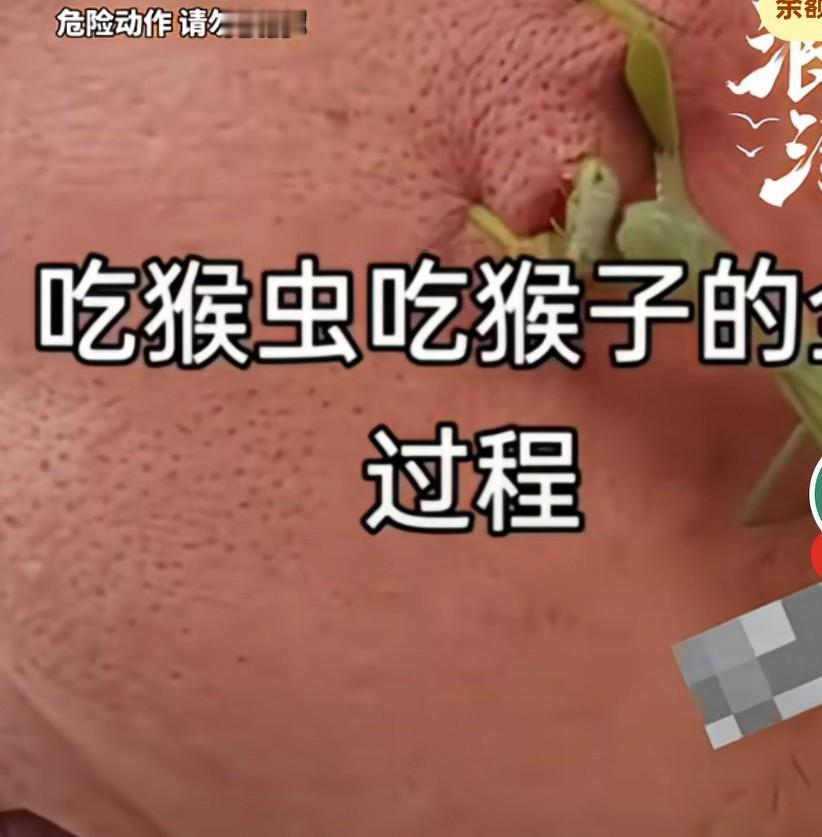 一名男子竟用一只螳螂吃掉脸上的“瘊子”，只见螳螂趴在男子脸上啃食瘊子，男子面无