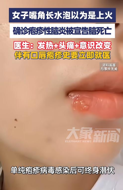 “太吓人了！”近日，陕西，一女子嘴角长了小水泡，以为是上火引起的“烂嘴角”，没放