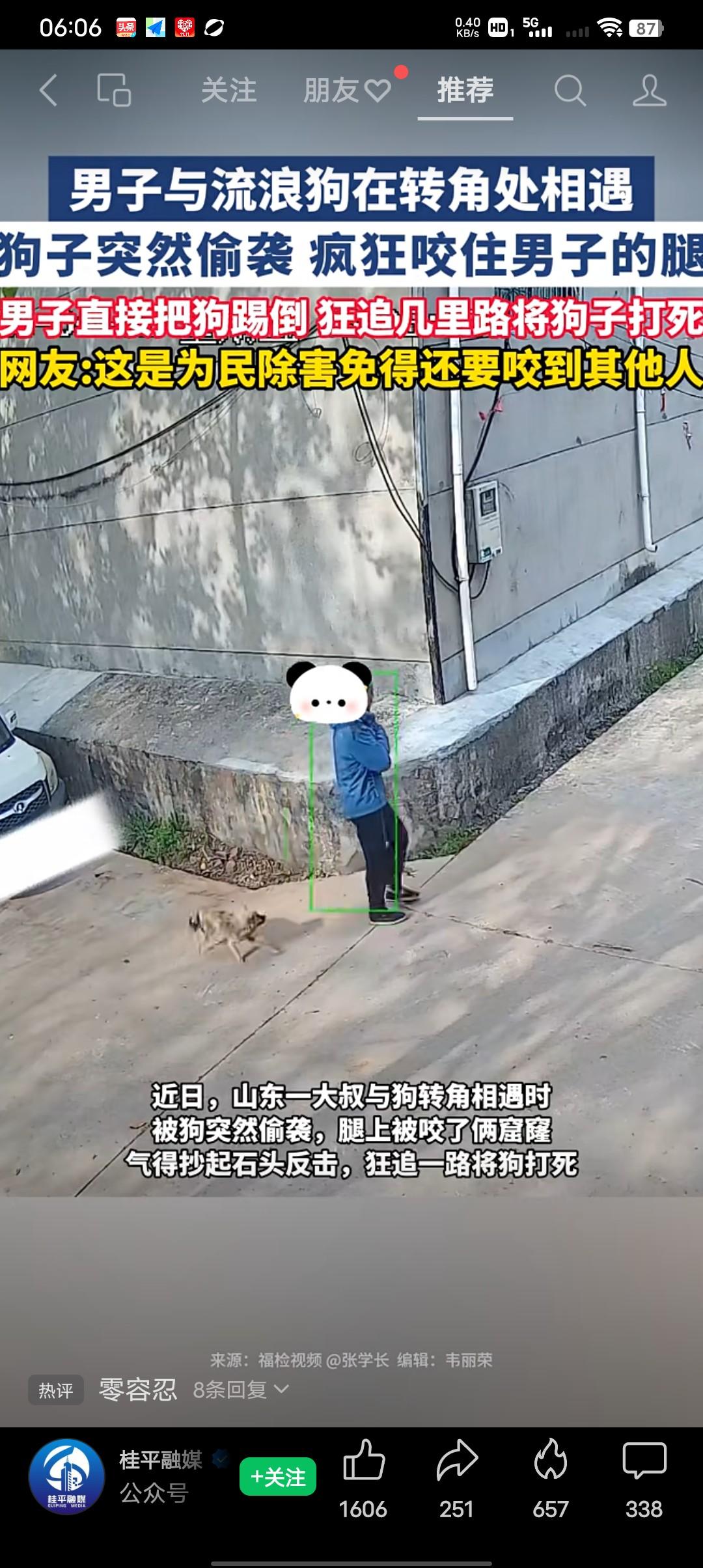 近日山东一大叔在散步的时候，在一个拐角处与流浪狗相遇，狗子突然偷袭，疯狂咬住男子