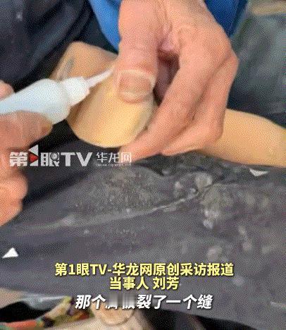 江苏无锡，一女子的假肢脚底板快断裂了，戴上行走时特别不方便，但女子询问假肢公司，