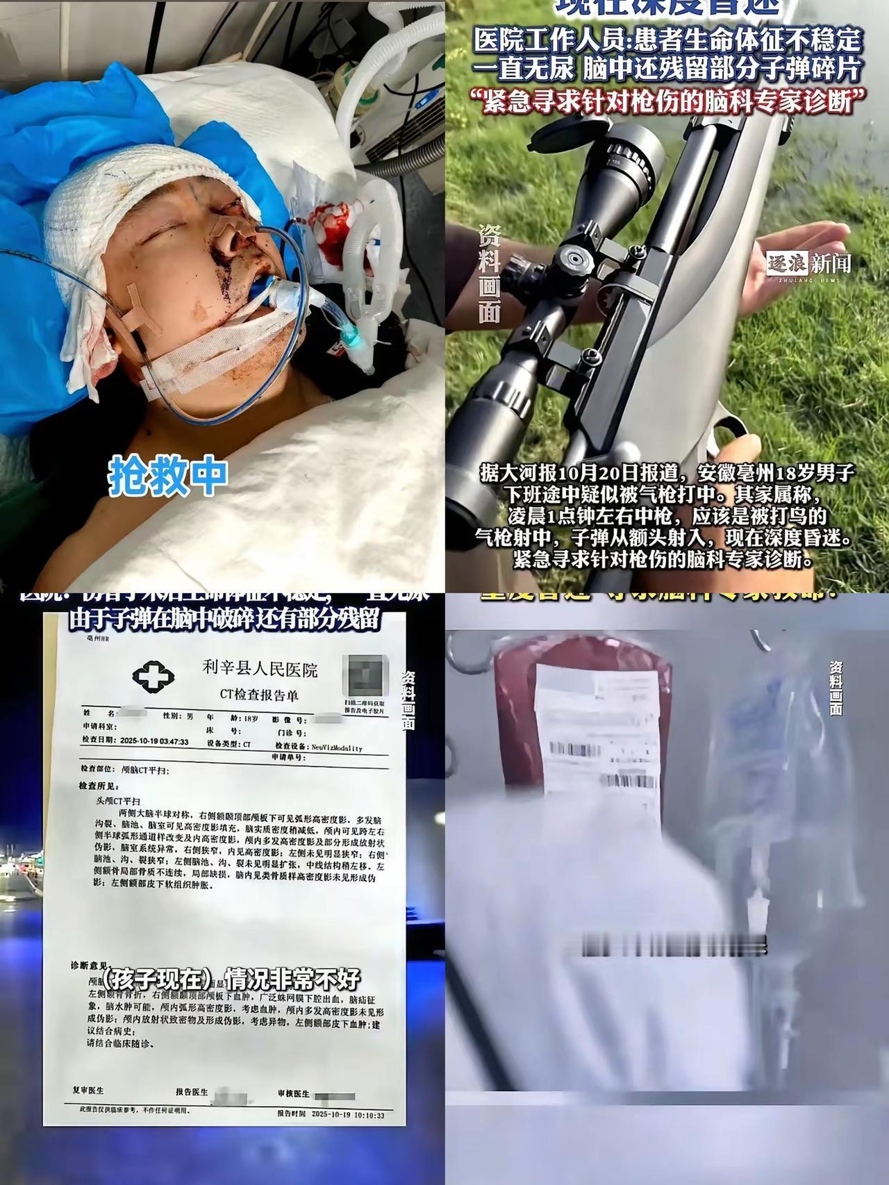 刷到安徽亳州这事儿,我手都在抖,18岁的小伙子,凌晨下班路上,就被黑暗里的气枪子