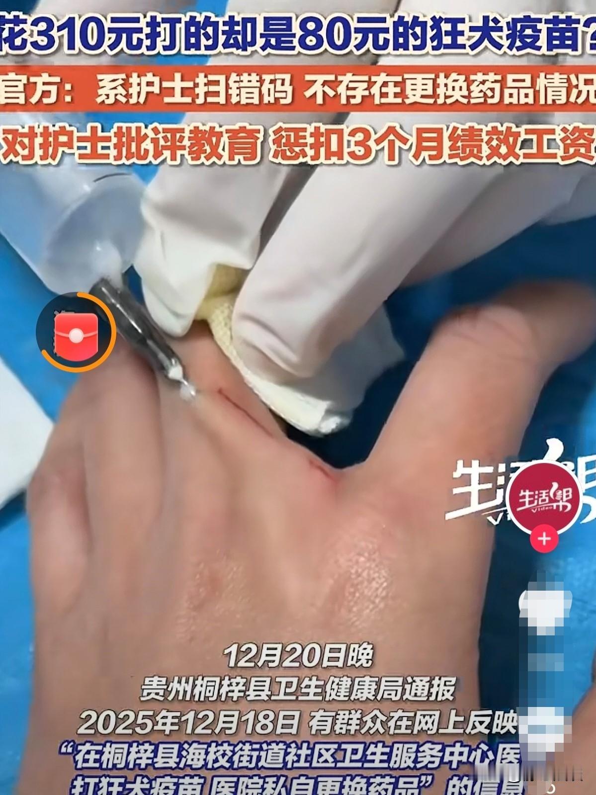 贵州，一男童被狗咬伤，家长赶紧带着孩子去打狂犬疫苗，为了安全起见，选择了310元