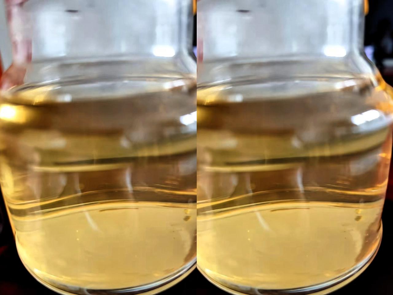我同事，把自己的一个肾，给了她28岁的儿子。尿毒症，双肾全坏了，不换，就没命