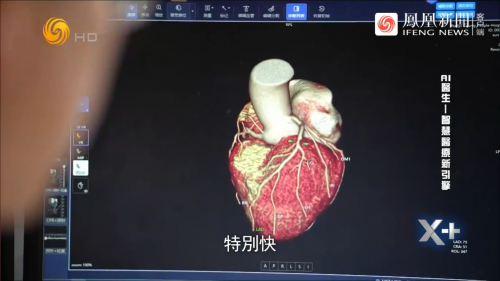 设备利用率提升110%、写病历快6倍! 这家县城医院偷偷开了大模型“外挂”