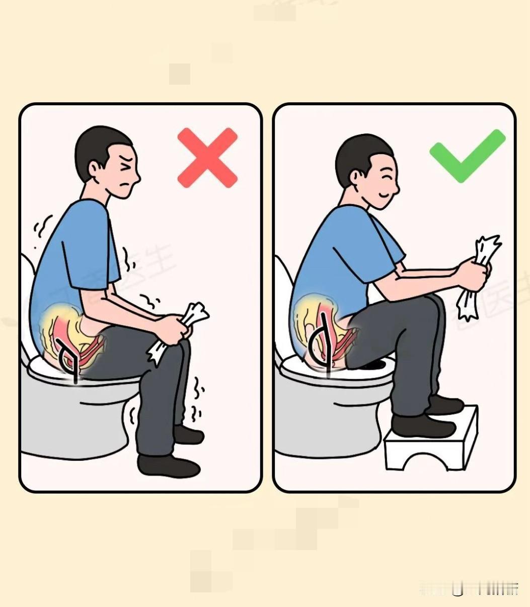 分享一个实用小妙招：蹲马桶的时候，脚上垫一个小凳子！这样，我们的肠道就是一