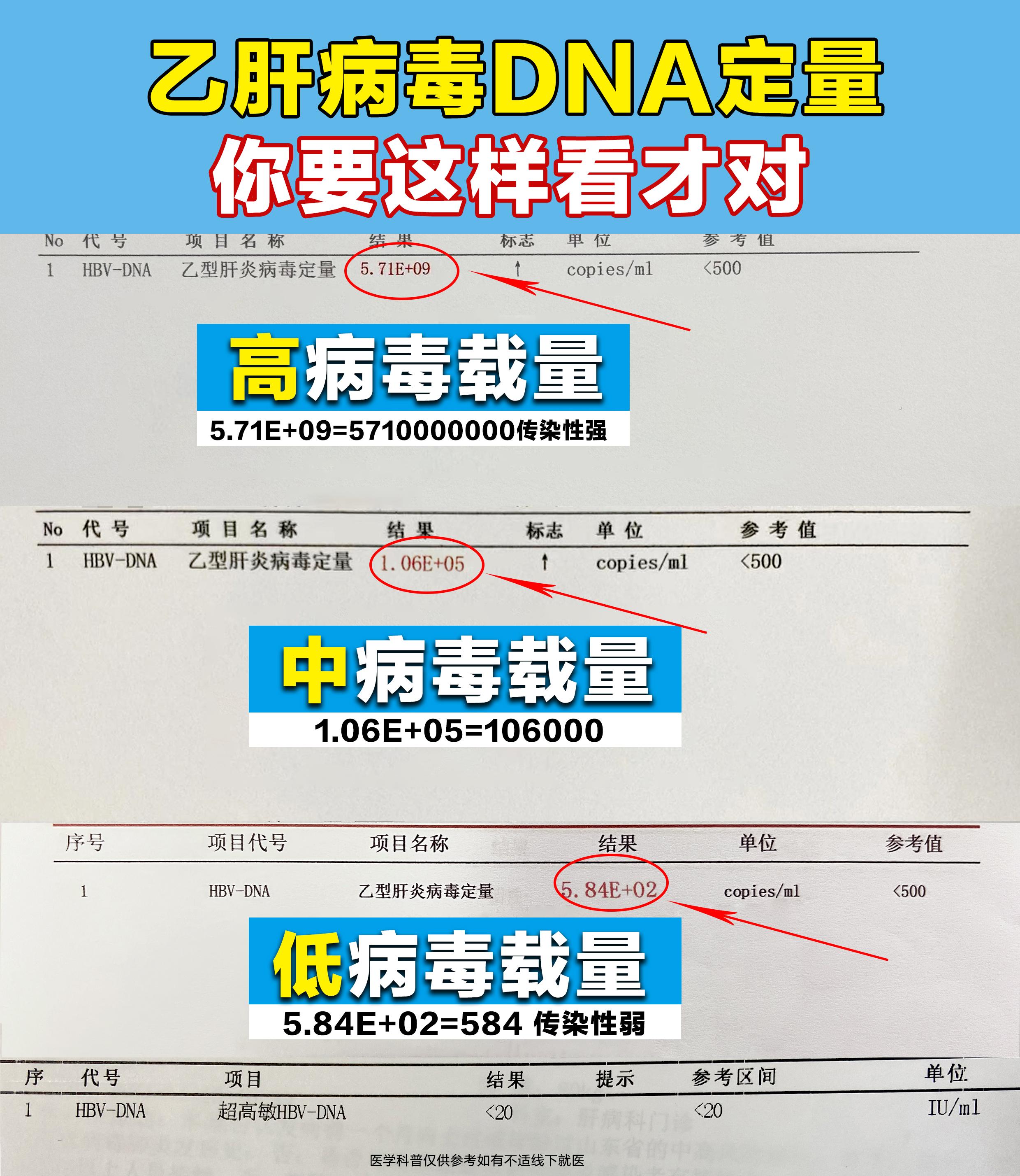 乙肝病毒DNA定量是判断病毒复制的金标准。数值越高，说明病毒越活跃，传...