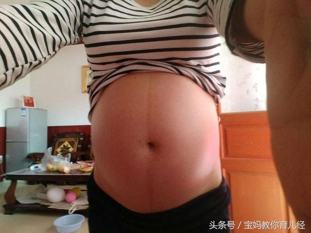 27岁产妇刚顺产下孩子, 突然浑身发冷, 医生掀开被子吓得腿发软
