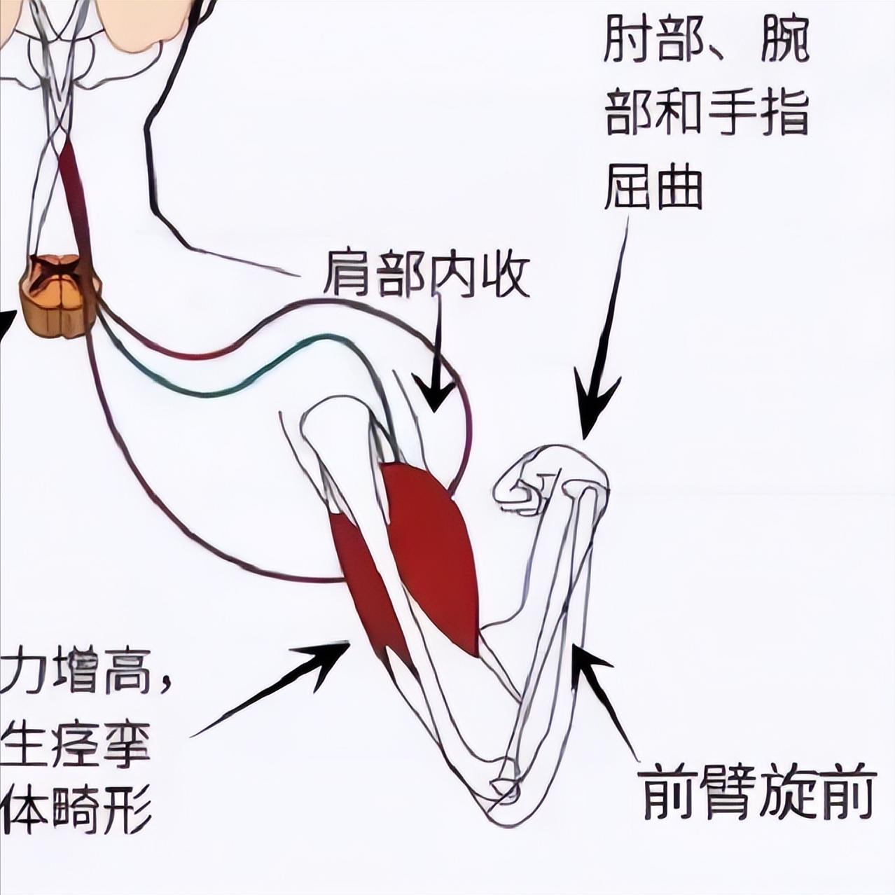 偏瘫后手臂伸不直？别硬拉，三个动作慢慢来一、被动伸展患者平躺或坐稳后，自己