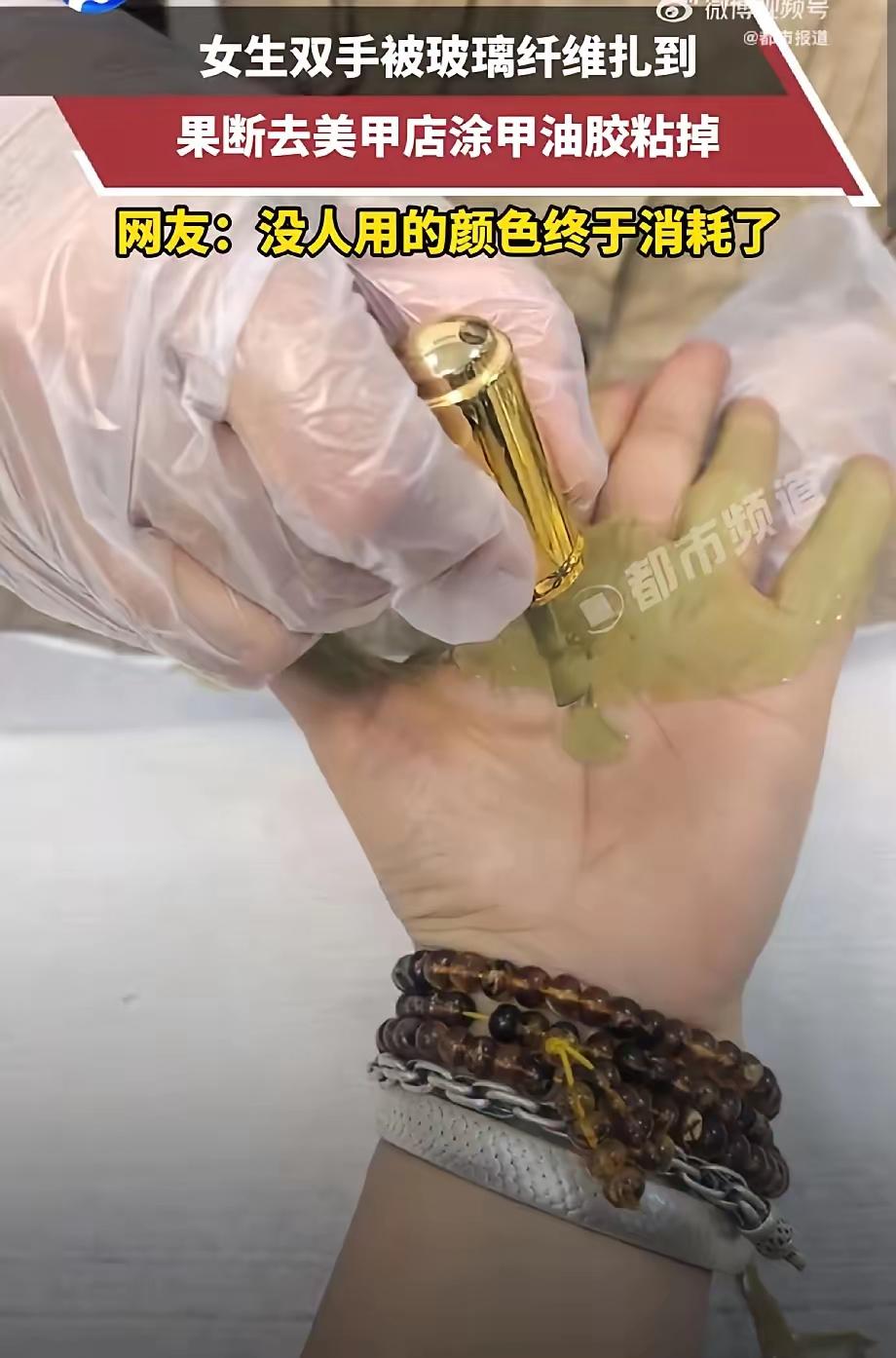 这是真聪明！5月13日报道浙江，一女生双手被玻璃纤维扎到，可她既没有自己拔，没有