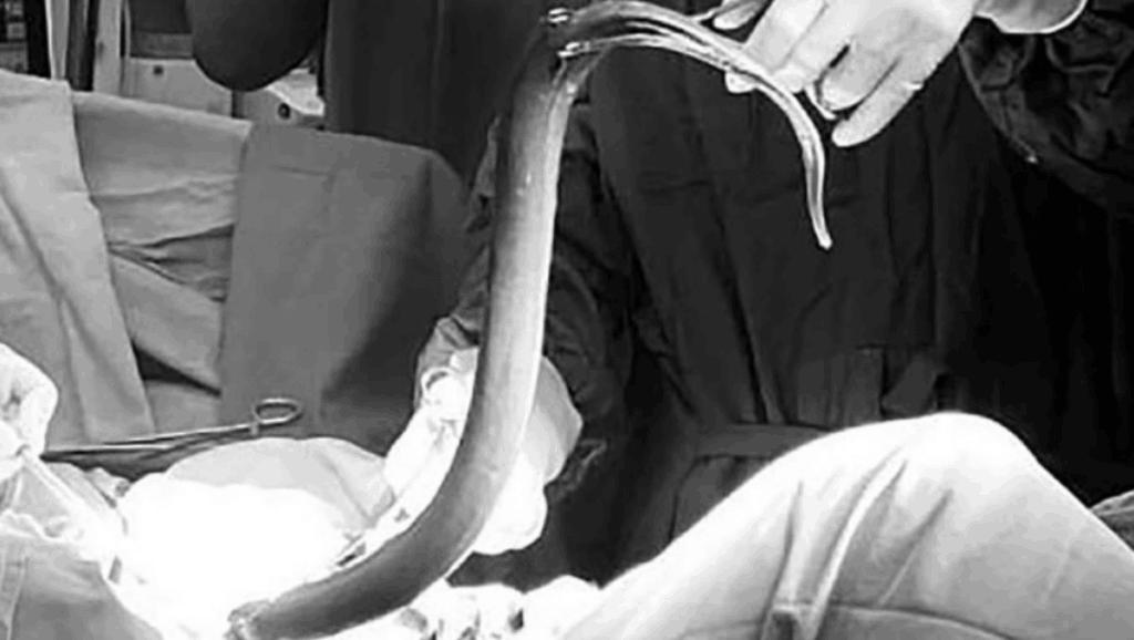 一名31岁的印度男子在越南因剧痛被紧急送往医院。当医生询问原因时……“我把一