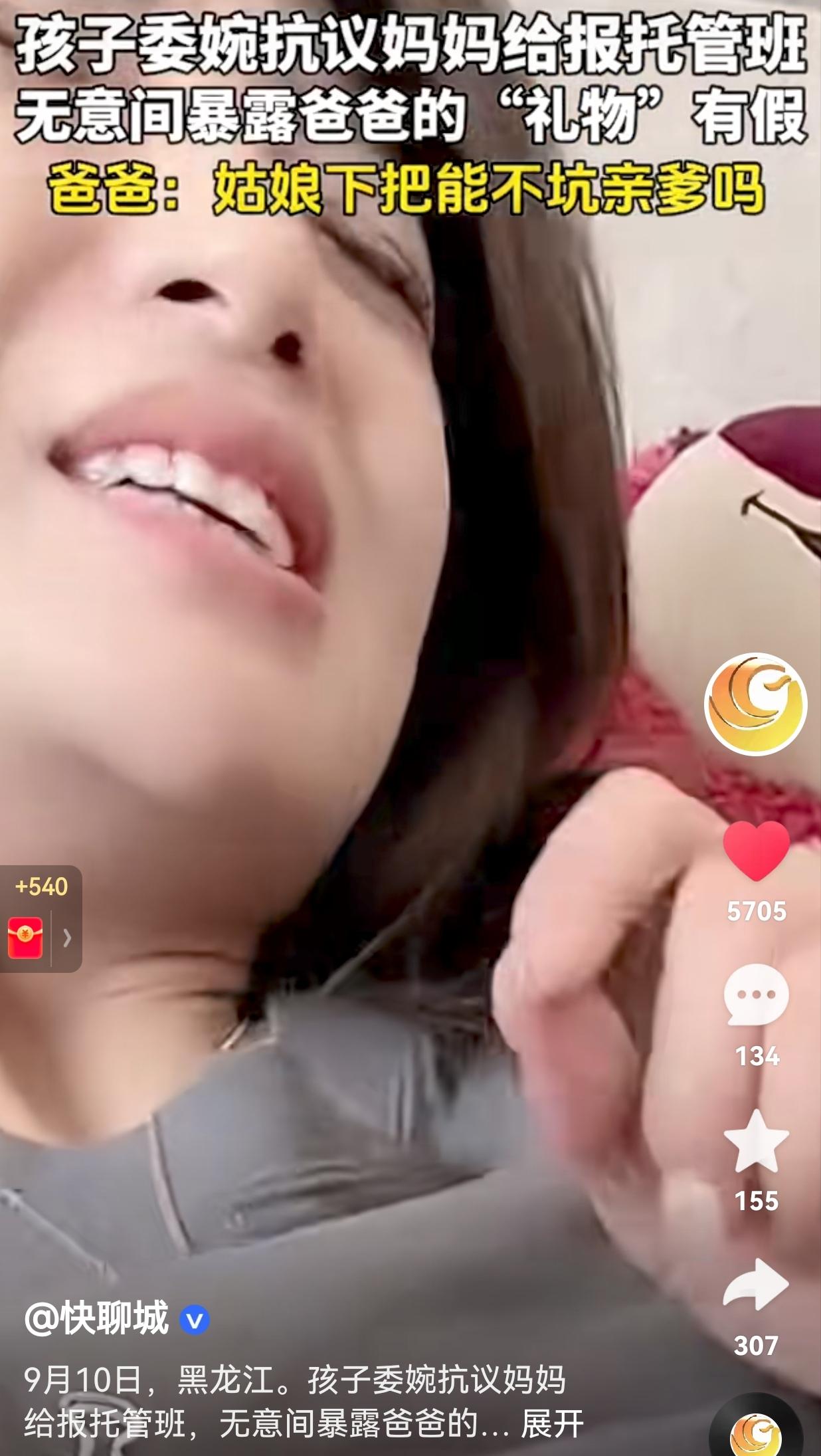 笑不活了！这是误伤盟军呀！9月10日，黑龙江，一孩子拿着吸铁石在妈妈胳膊上划来划