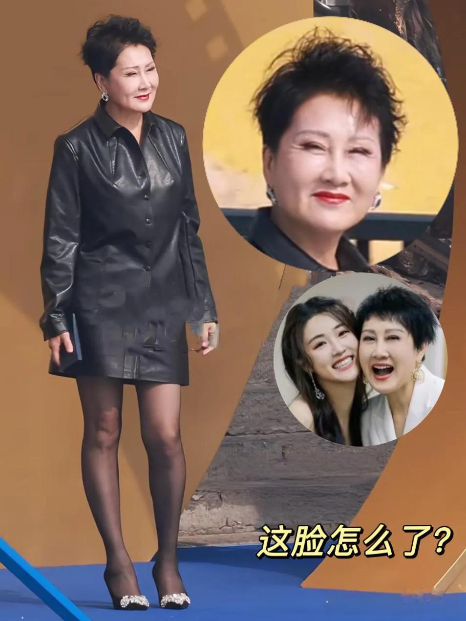 这是“慧芳”张凯丽吗?脸型变了不说,她的眼睛好像睁不开了,怎么回事?本是一个朴