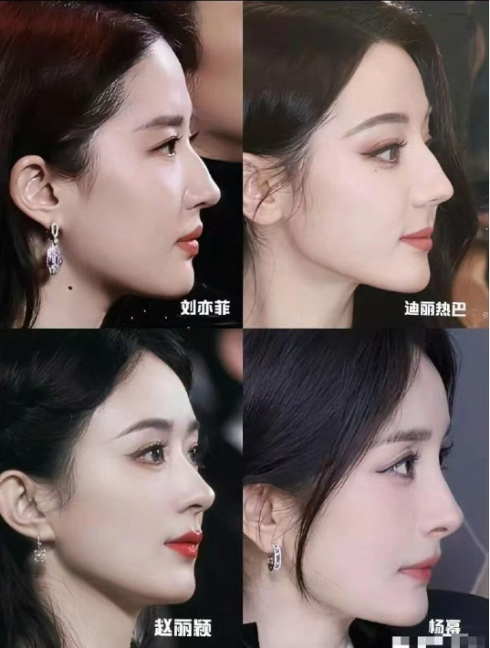 四个最美的侧脸颜，你们喜欢哪个呢？​​​