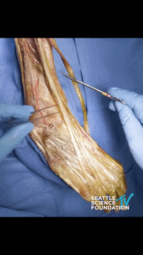 脚趾从解剖看康复——你知道你的脚趾是如何勾起来的吗？连接大脚趾的肌肉称为𧿹长