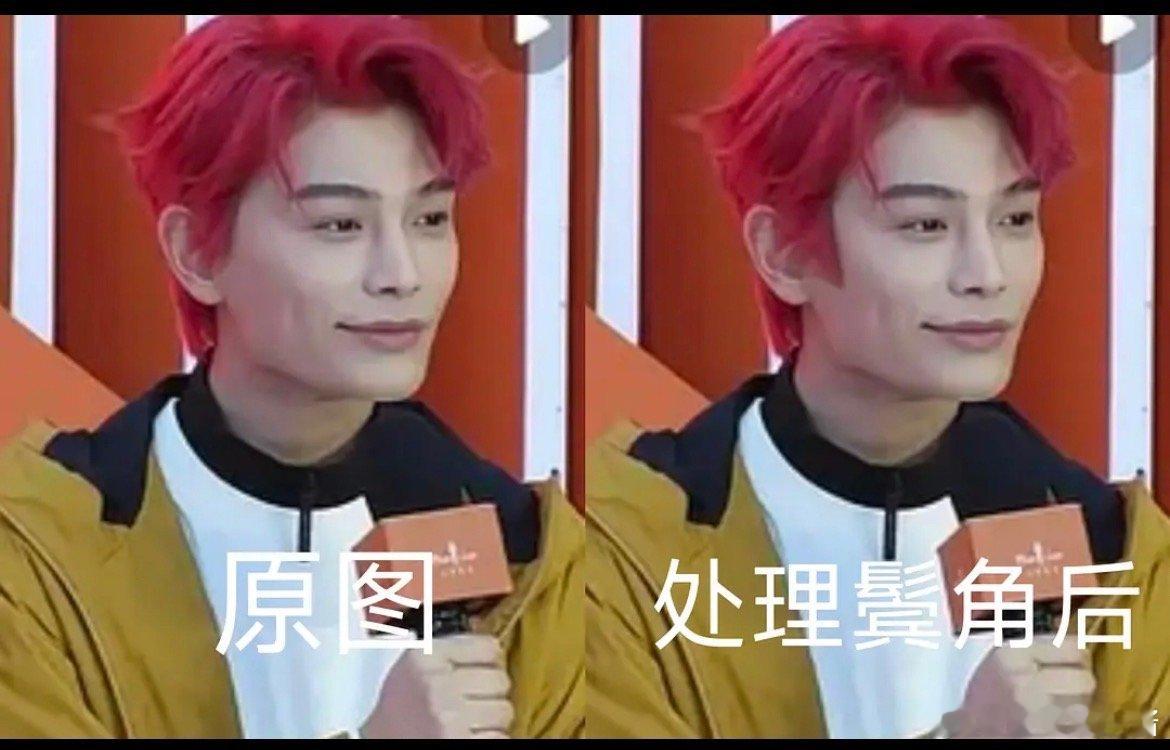 丁禹兮鬓角弄到颧骨就看起来不奇怪了吗