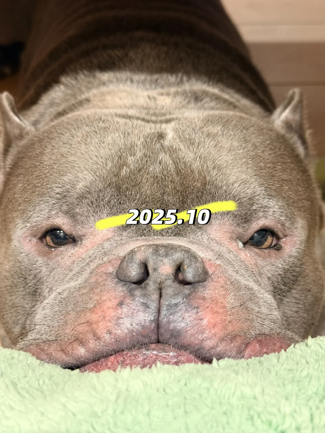 应该是东北冬天太干了！