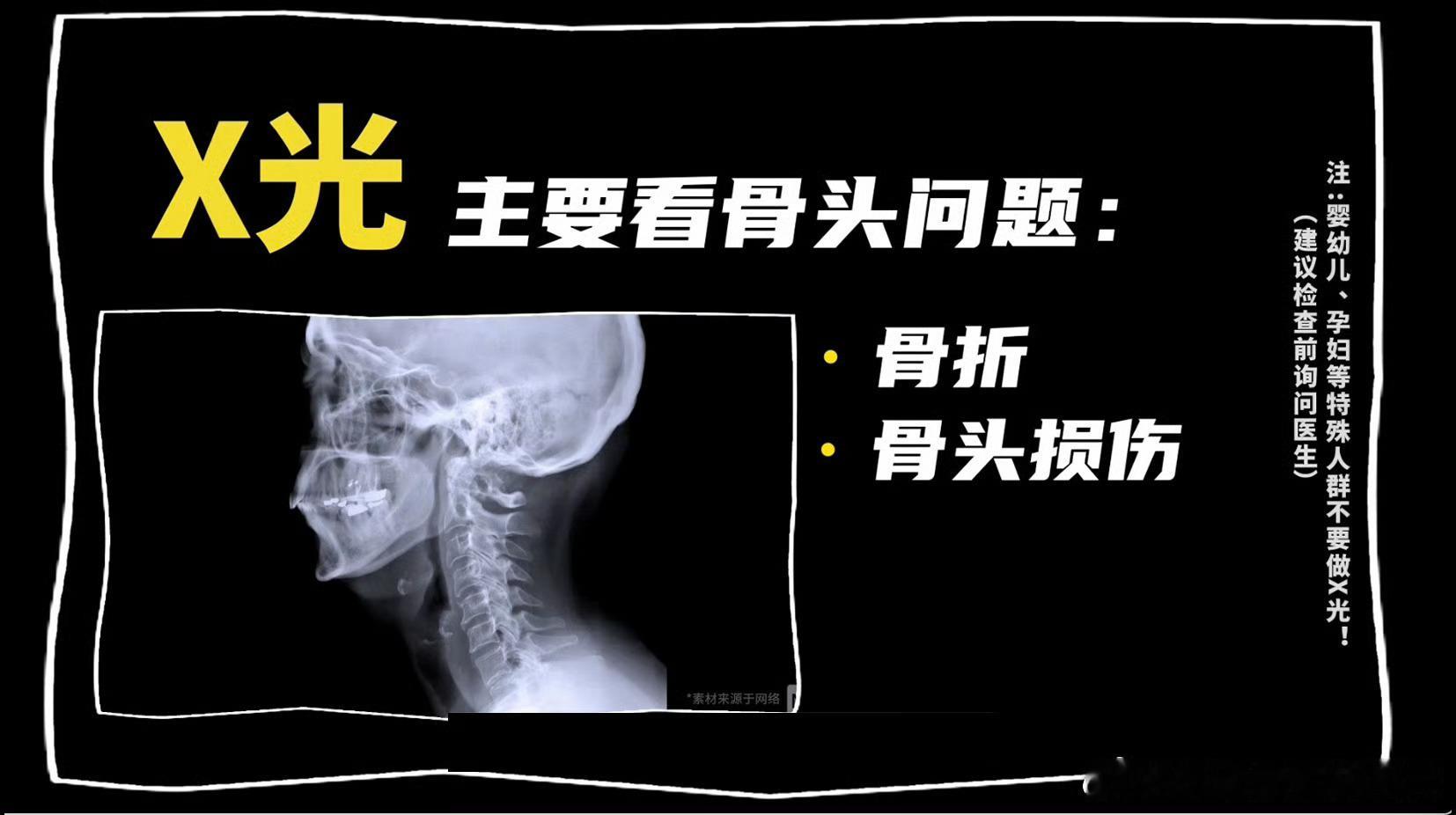 全国医院放射检查费大降价X光、CT、核磁，普通人很难分清这些统称的“片子”到底