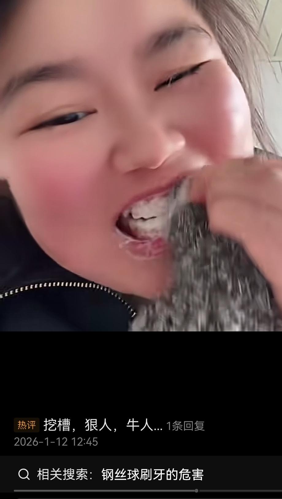 你见过用钢丝球刷牙吗？我真是惊呆了，某女子嫌牙刷刷不干净，用上了钢丝球。大家