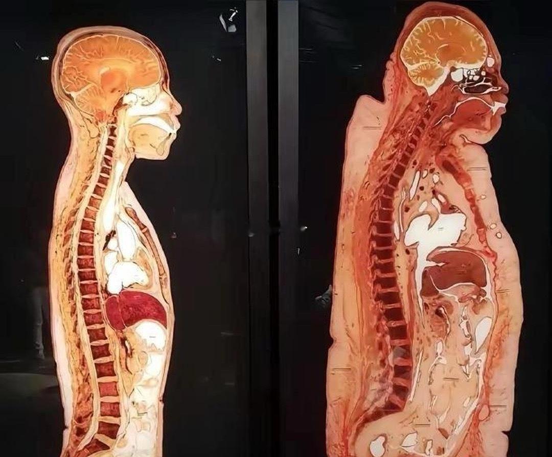 感受一下瘦子和胖子的直接差别