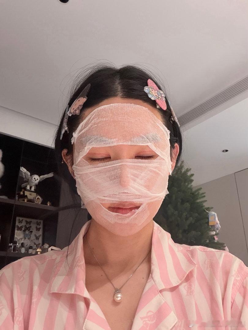 双眼皮半个月啦！！！！闭眼和睁眼恢复的都很好今天开始狠狠护肤用一下南瓜水敷完