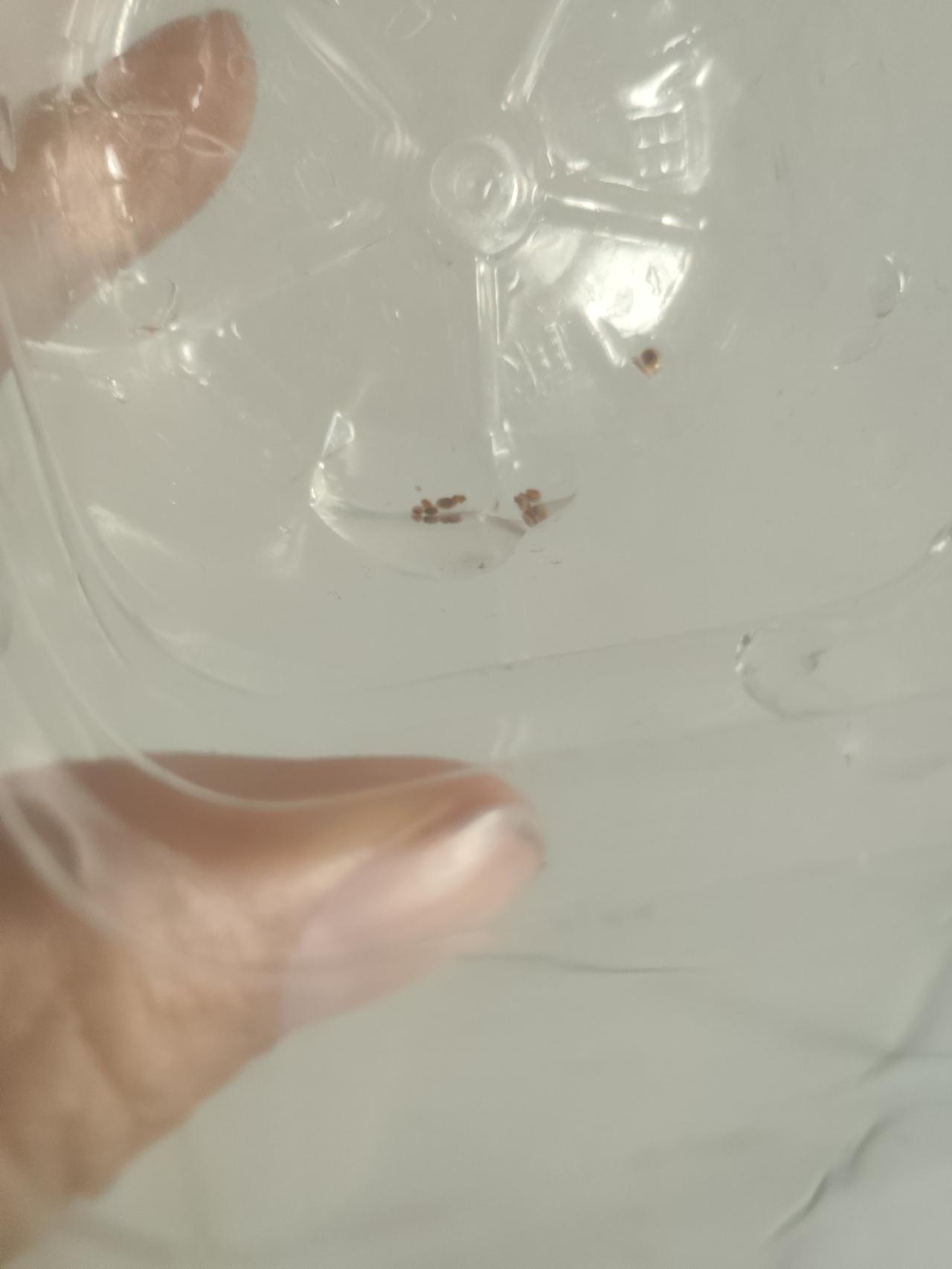 无语了，多喝水，注意高嘌呤，草酸高的食物忌口，坚持每天走八千步！能做的几乎都