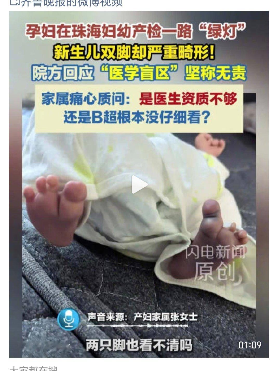 产检绿灯新生儿双脚却严重畸形你要说别的也就算了，这脚会看不清？产检我觉得起码真的