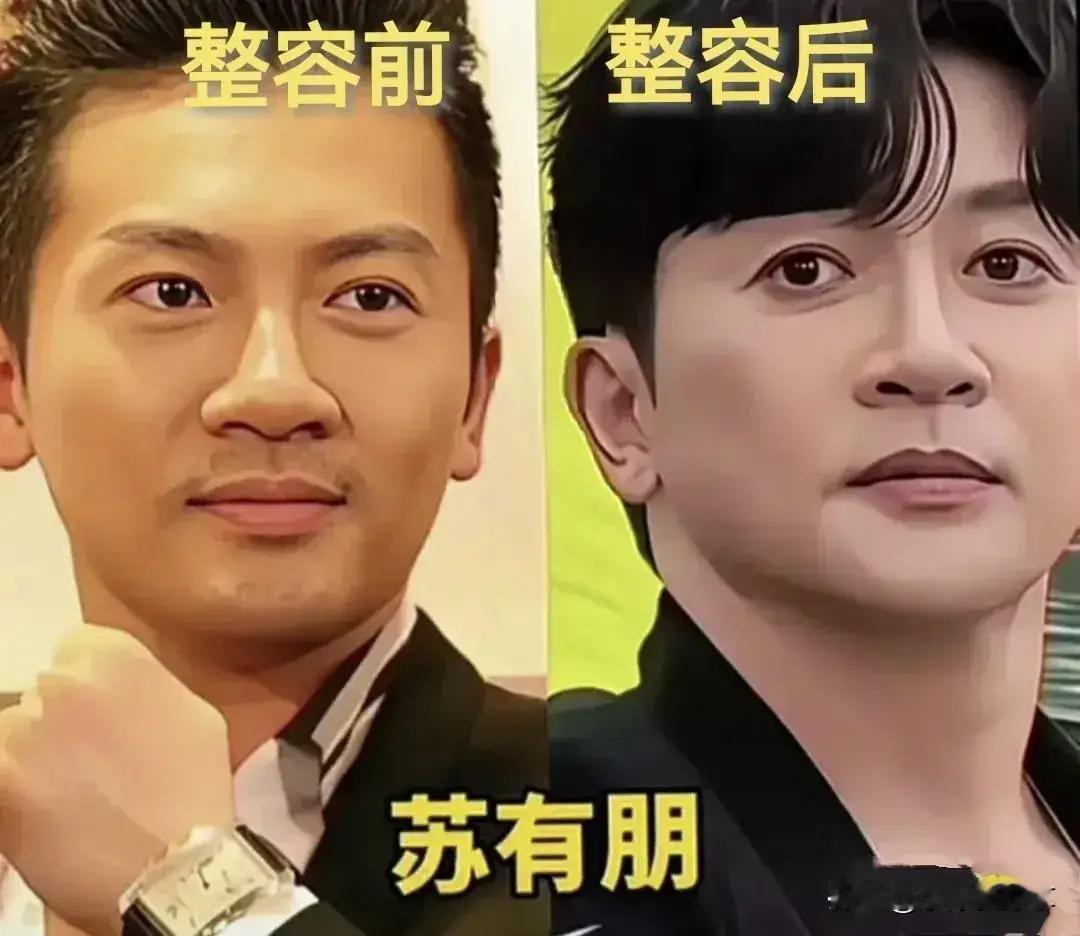 整容后的苏有朋没有以前帅了。整容后的陈浩民没有以前帅了。整容后的刘恺威没有以