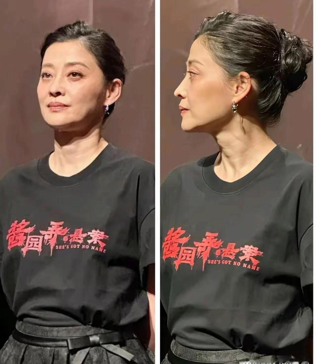 梅婷那张近照，颧骨凸出瘦到脱相，我还以为看错了。灯光一打，法令纹深陷，那种疲惫