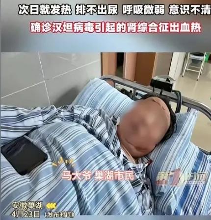 “无知害死人”！安徽巢湖的马大爷，一天，家里突然飞进来一只蝙蝠，他本来想抓住蝙蝠