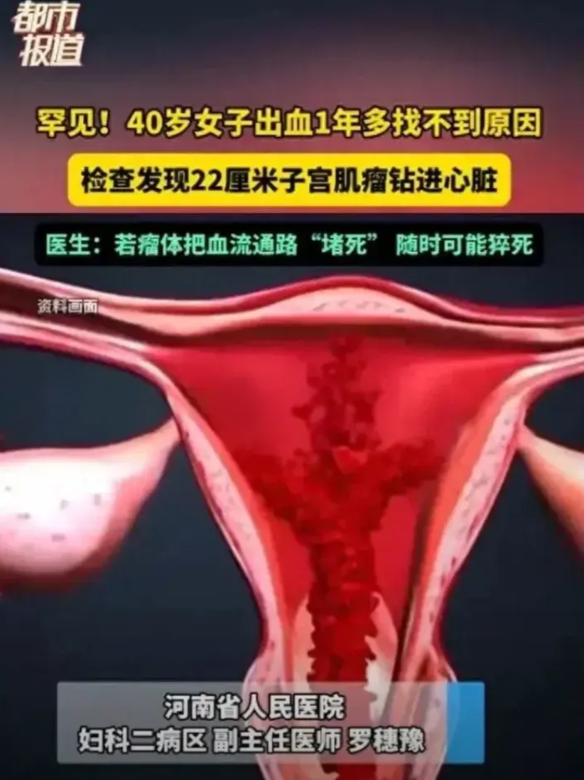 “不幸中的万幸!”河南的一位40岁的女子，因月经异常多次就医，然而一直未能查出病
