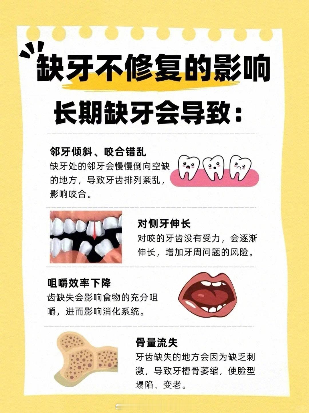 口腔知识小科普🦷😄缺牙不修复的影响长期缺牙会导致🤔:1⃣邻牙倾斜、咬合错乱
