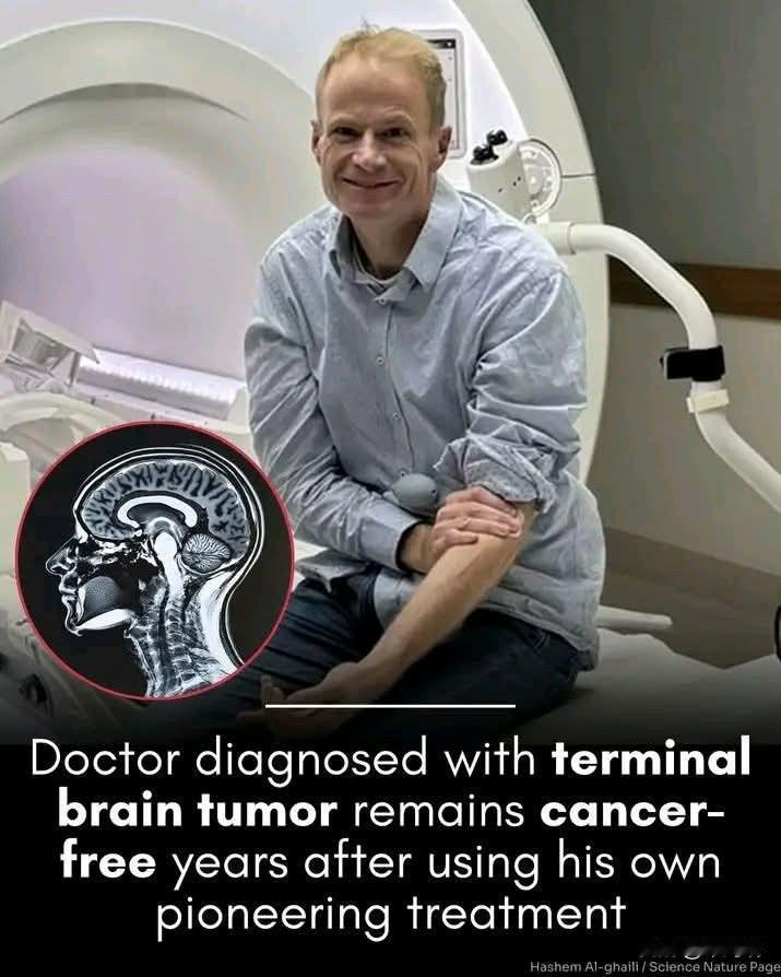 胶质母细胞瘤患者的生存期通常不到一年。但澳大利亚医生理查德·斯科利尔在接受一项突