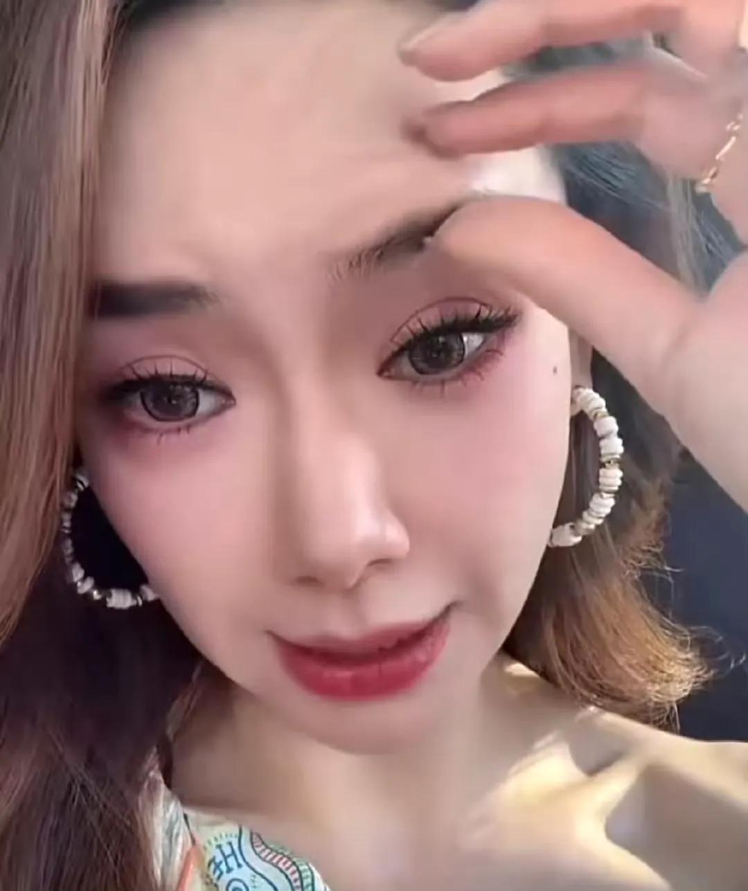 戚薇大胆承认整容，翻出她没整之前的照片，对比太残忍2025年3月，戚薇因上节