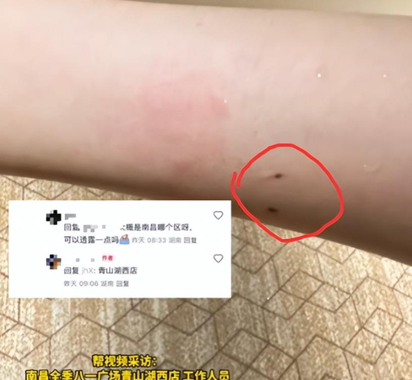 太恶心了！7月11日江西南昌，一女子入住酒店，半夜睡觉时，隐约间手臂感到很疼，当